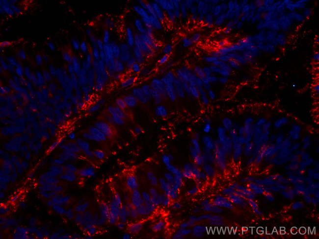 Galectin-4 Antibody in Immunohistochemistry (Paraffin) (IHC (P))