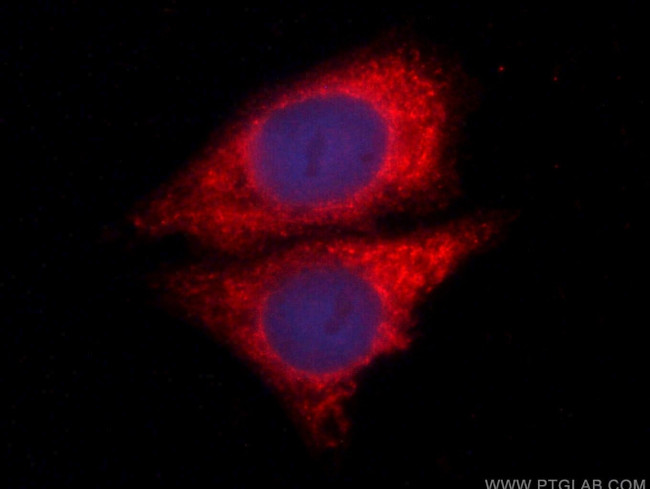 NEUROD1 Antibody in Immunocytochemistry (ICC/IF)