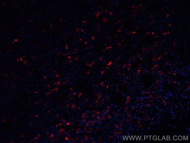 TSH Beta Antibody in Immunohistochemistry (Paraffin) (IHC (P))