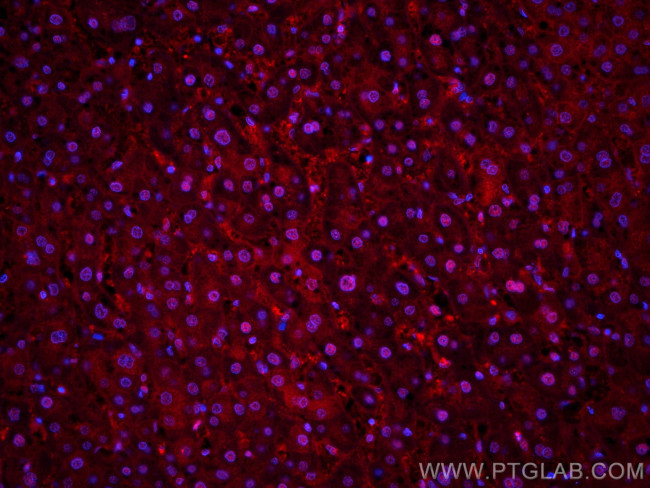 PSMB8 Antibody in Immunohistochemistry (Paraffin) (IHC (P))