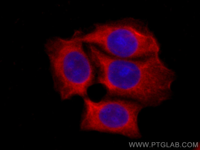 HSP27 Antibody in Immunocytochemistry (ICC/IF)