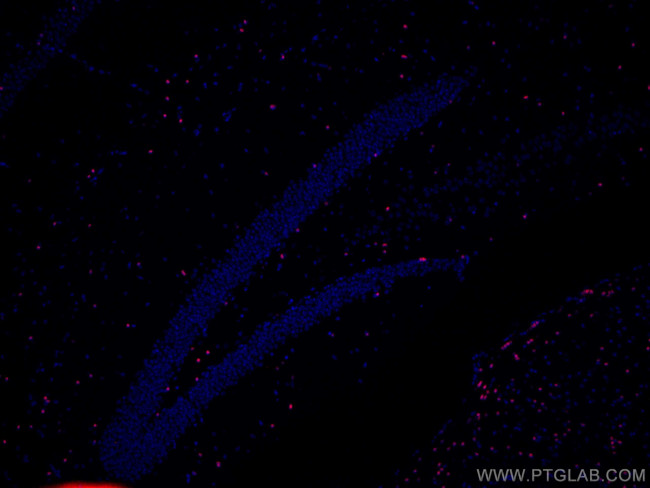 SOX10 Antibody in Immunohistochemistry (Paraffin) (IHC (P))