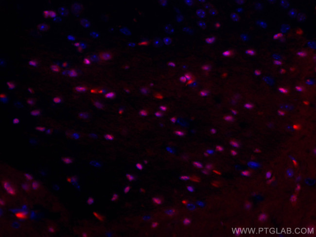 SOX10 Antibody in Immunohistochemistry (Paraffin) (IHC (P))