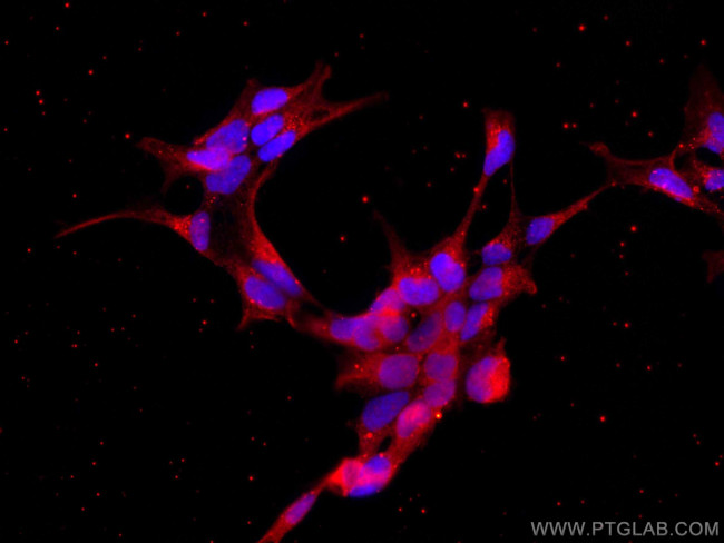 CRACR2A Antibody in Immunocytochemistry (ICC/IF)