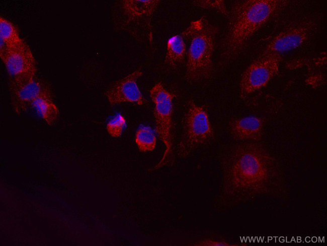 HPGD Antibody in Immunocytochemistry (ICC/IF)