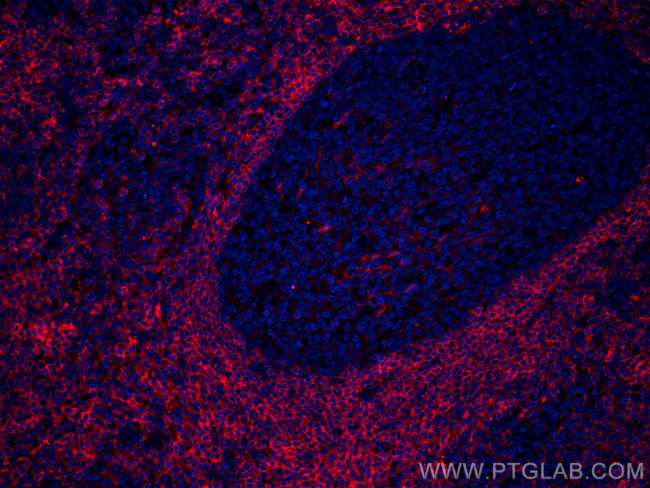 CCR6 Antibody in Immunohistochemistry (Paraffin) (IHC (P))