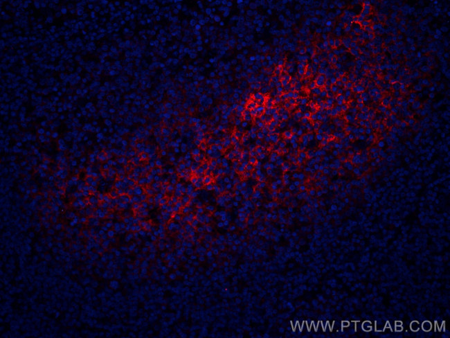 CD82 Antibody in Immunohistochemistry (Paraffin) (IHC (P))