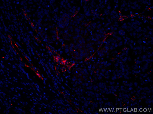 VE-cadherin Antibody in Immunohistochemistry (Paraffin) (IHC (P))