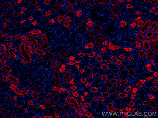 AQP1 Antibody in Immunohistochemistry (Paraffin) (IHC (P))