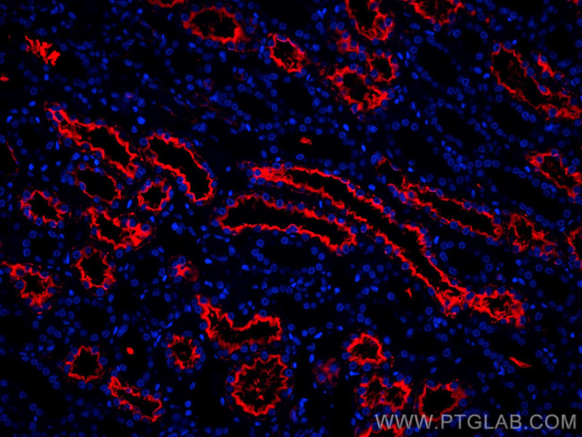 AQP1 Antibody in Immunohistochemistry (Paraffin) (IHC (P))