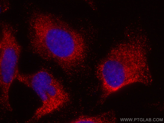 GRB2 Antibody in Immunocytochemistry (ICC/IF)