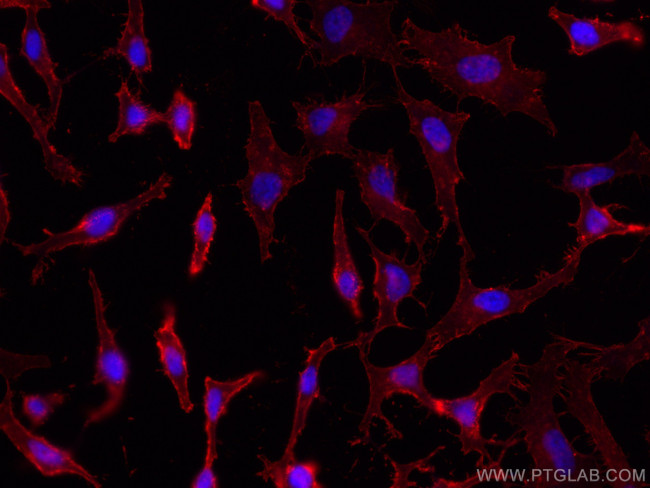 CD98/SLC3A2 Antibody in Immunocytochemistry (ICC/IF)