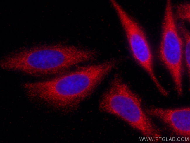 SPTLC1 Antibody in Immunocytochemistry (ICC/IF)