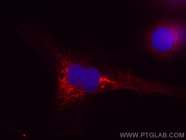 Calnexin Antibody in Immunocytochemistry (ICC/IF)