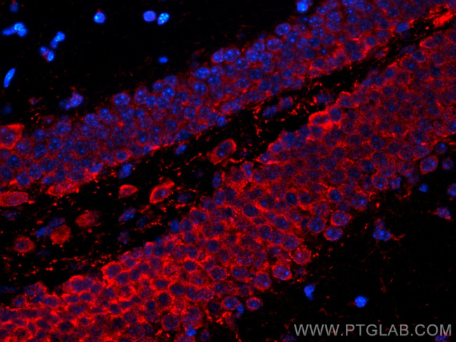 PTGER4 Antibody in Immunohistochemistry (Paraffin) (IHC (P))