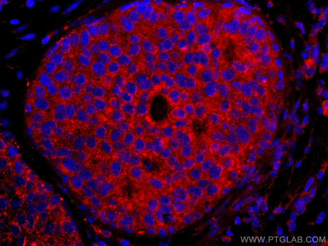 ROR1 Antibody in Immunohistochemistry (Paraffin) (IHC (P))