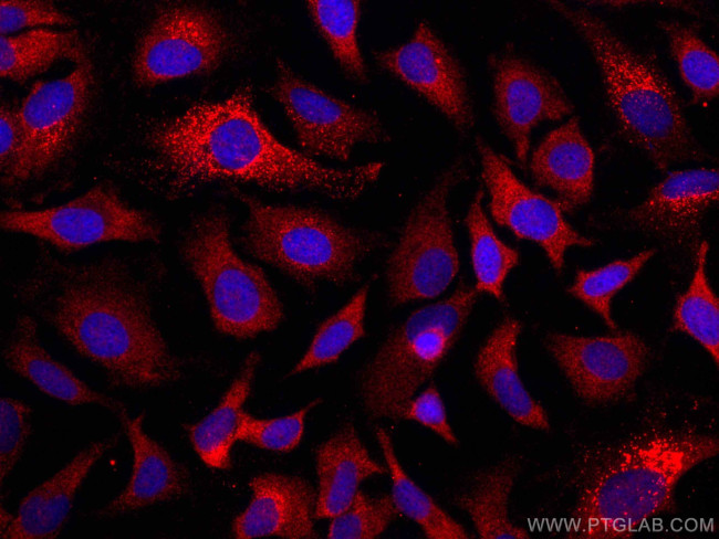 GPNMB Antibody in Immunocytochemistry (ICC/IF)