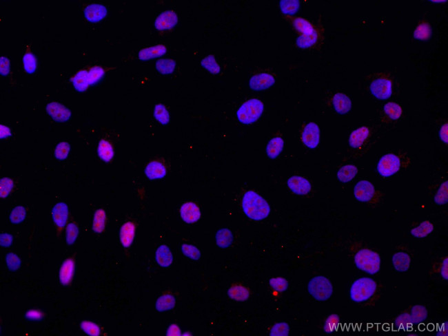 DBR1 Antibody in Immunocytochemistry (ICC/IF)