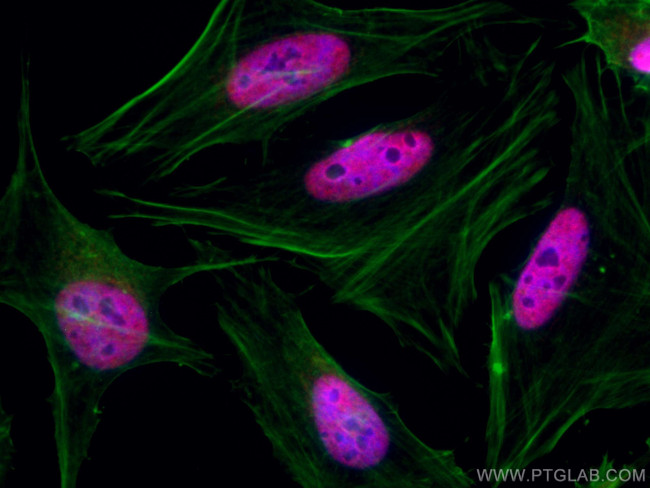 TBL1X Antibody in Immunocytochemistry (ICC/IF)