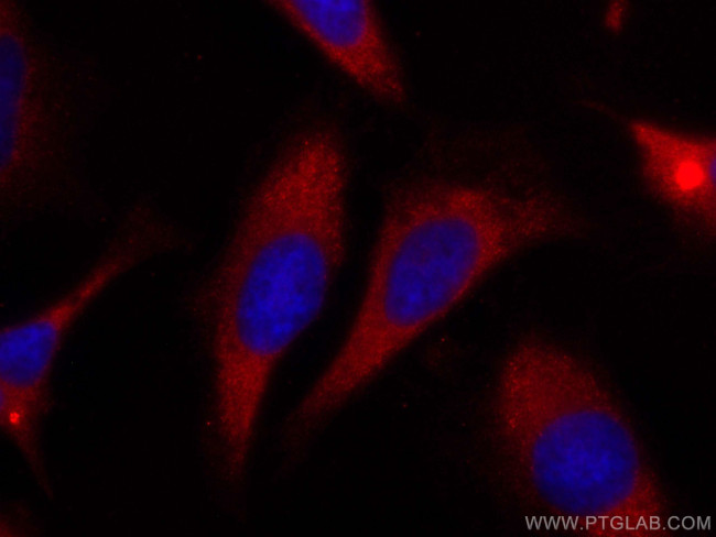 hIST1 Antibody in Immunocytochemistry (ICC/IF)