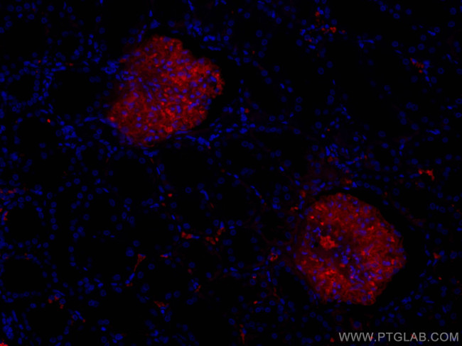 PTPRO Antibody in Immunohistochemistry (Paraffin) (IHC (P))