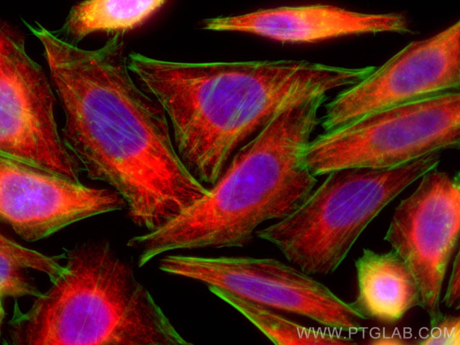 fetuin-B Antibody in Immunocytochemistry (ICC/IF)