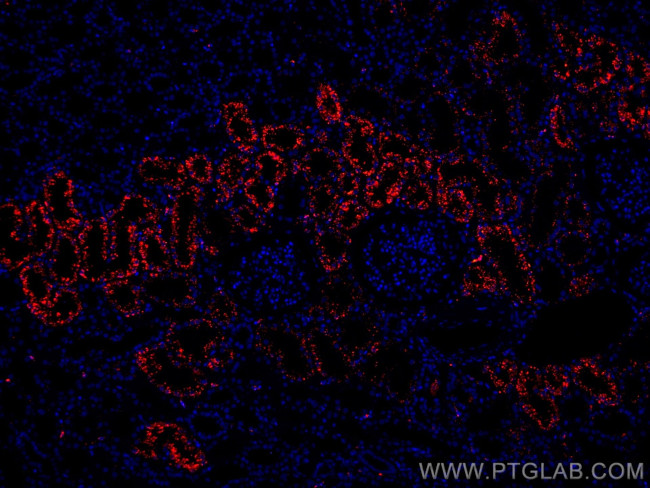 LGMN Antibody in Immunohistochemistry (Paraffin) (IHC (P))