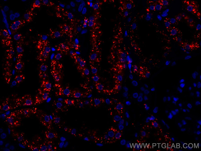 LGMN Antibody in Immunohistochemistry (Paraffin) (IHC (P))