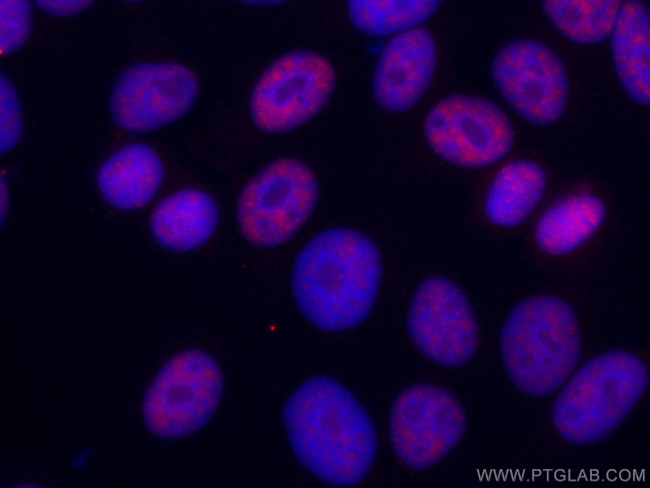 DDX5 Antibody in Immunocytochemistry (ICC/IF)