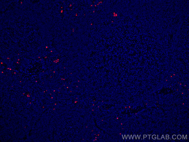 PRTN3 Antibody in Immunohistochemistry (Paraffin) (IHC (P))