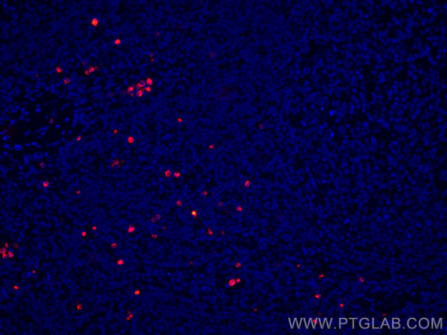 PRTN3 Antibody in Immunohistochemistry (Paraffin) (IHC (P))