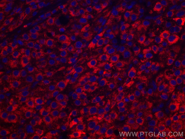 CYP27A1 Antibody in Immunohistochemistry (Paraffin) (IHC (P))