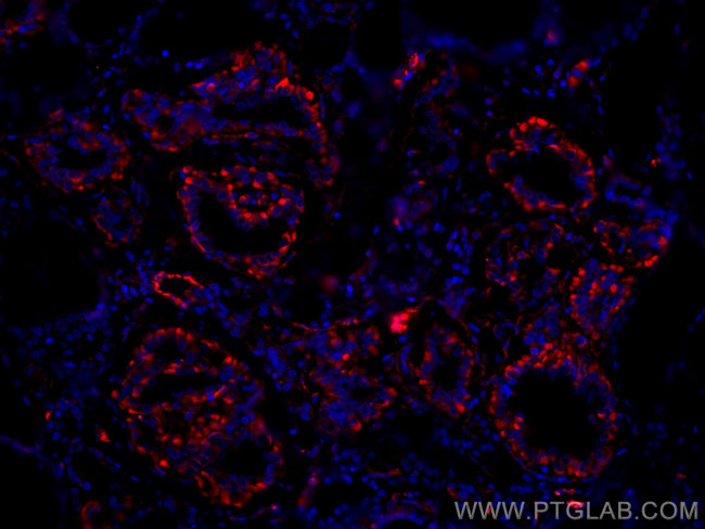 GUK1 Antibody in Immunohistochemistry (Paraffin) (IHC (P))