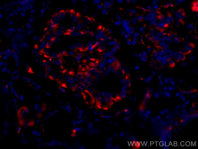 GUK1 Antibody in Immunohistochemistry (Paraffin) (IHC (P))