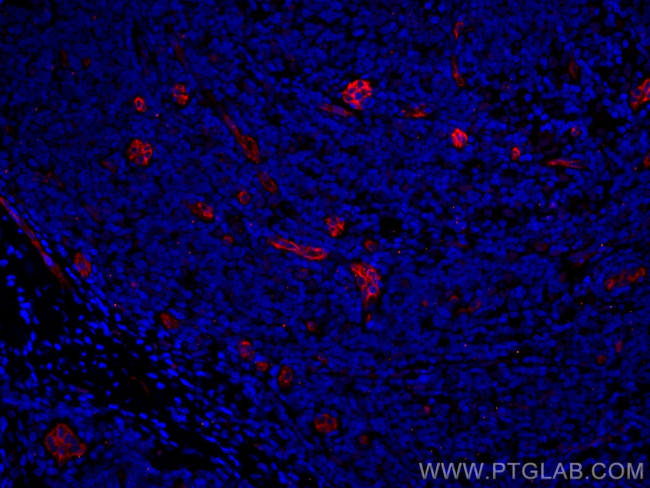 Endoglin/CD105 Antibody in Immunohistochemistry (Paraffin) (IHC (P))