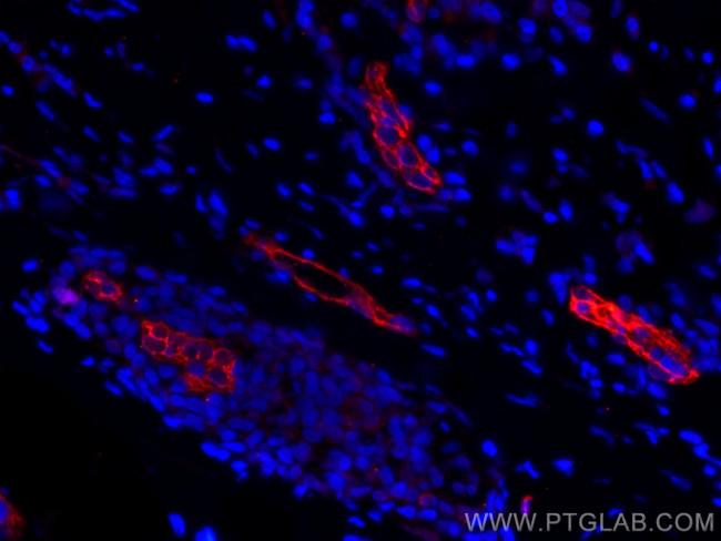 Endoglin/CD105 Antibody in Immunohistochemistry (Paraffin) (IHC (P))