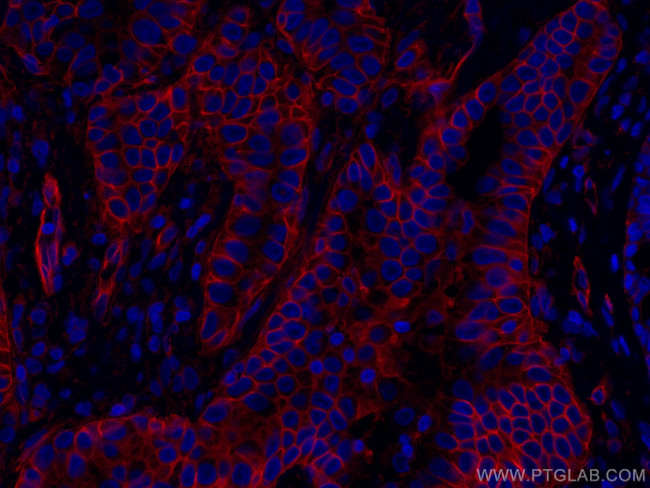 RALB Antibody in Immunohistochemistry (Paraffin) (IHC (P))