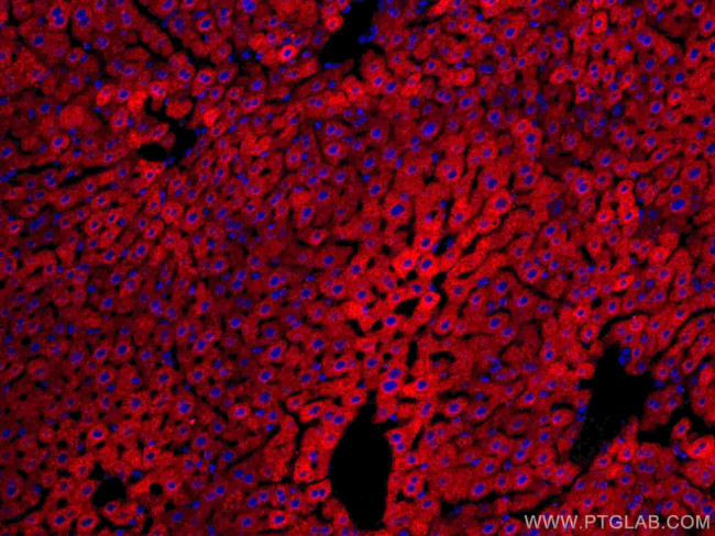 CYP3A4 Antibody in Immunohistochemistry (Paraffin) (IHC (P))