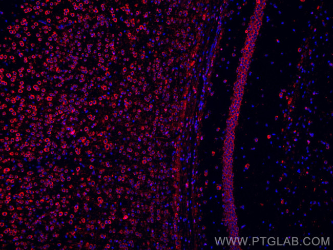 L1CAM Antibody in Immunohistochemistry (Paraffin) (IHC (P))