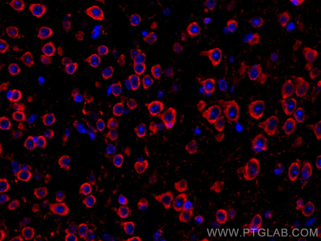 L1CAM Antibody in Immunohistochemistry (Paraffin) (IHC (P))