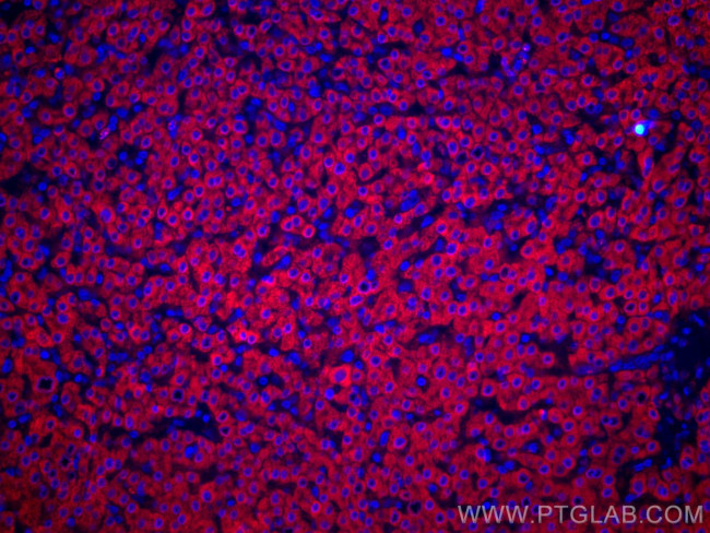 GCK Antibody in Immunohistochemistry (Paraffin) (IHC (P))