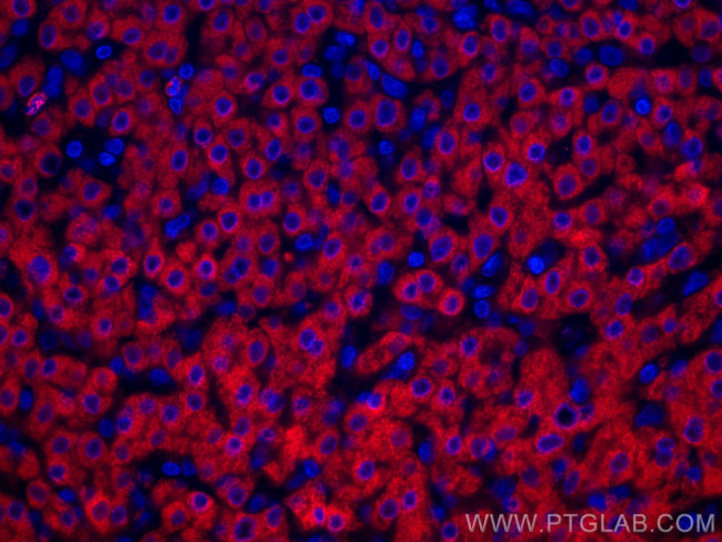 GCK Antibody in Immunohistochemistry (Paraffin) (IHC (P))