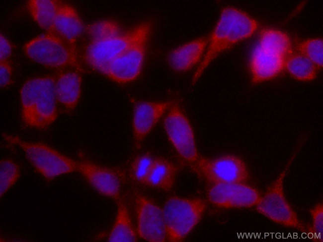 VAMP4 Antibody in Immunocytochemistry (ICC/IF)