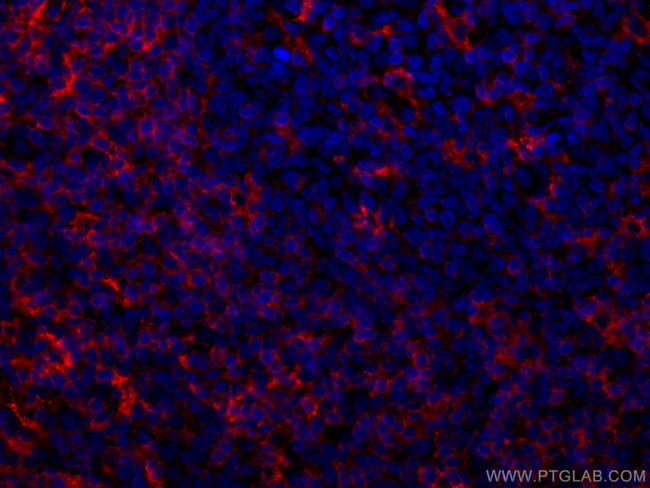 LAIR1 Antibody in Immunohistochemistry (Paraffin) (IHC (P))