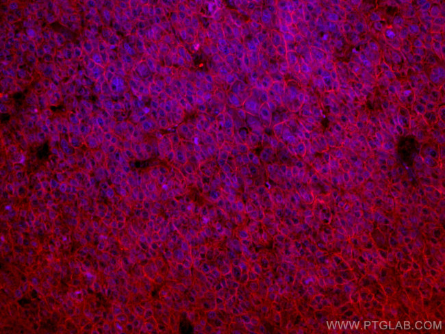 SLC31A1 Antibody in Immunohistochemistry (Paraffin) (IHC (P))