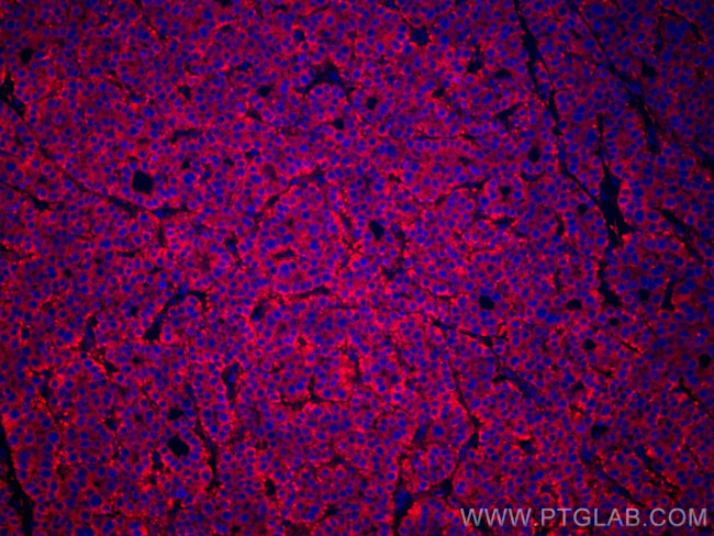 FUCA1 Antibody in Immunohistochemistry (Paraffin) (IHC (P))