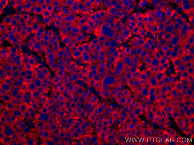 FUCA1 Antibody in Immunohistochemistry (Paraffin) (IHC (P))