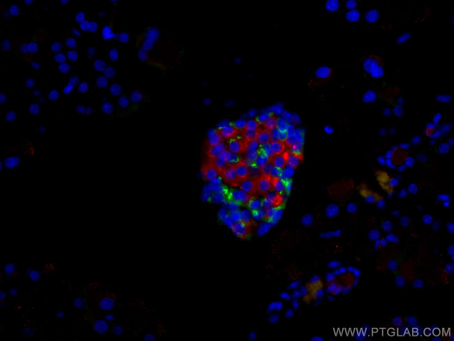 Ins1 Antibody in Immunohistochemistry (Paraffin) (IHC (P))