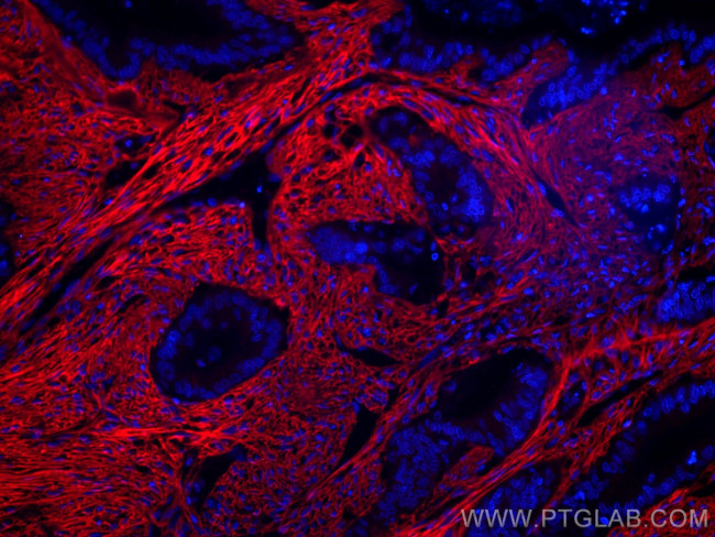 Collagen Type I Antibody in Immunohistochemistry (Paraffin) (IHC (P))