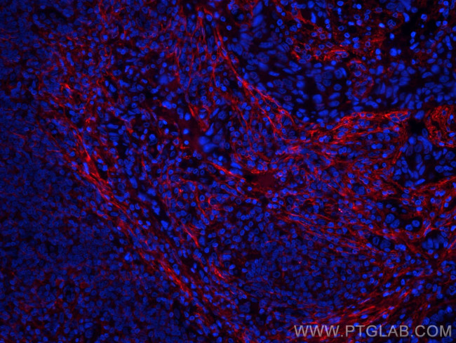 Collagen Type I Antibody in Immunohistochemistry (Paraffin) (IHC (P))